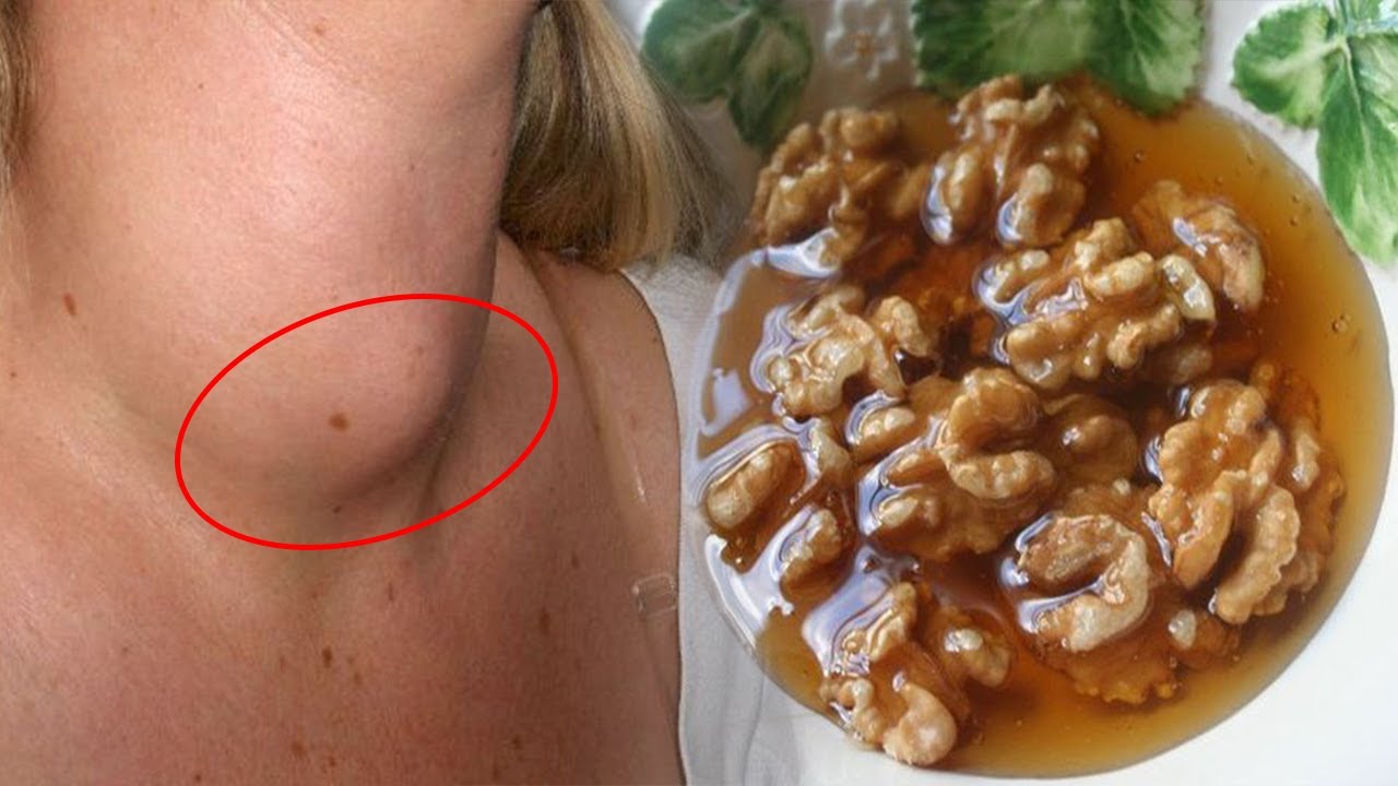 Mjekët jua kanë fshehur: Kjo është receta e vetme që shëron gjëndrën tiroide (VIDEO)