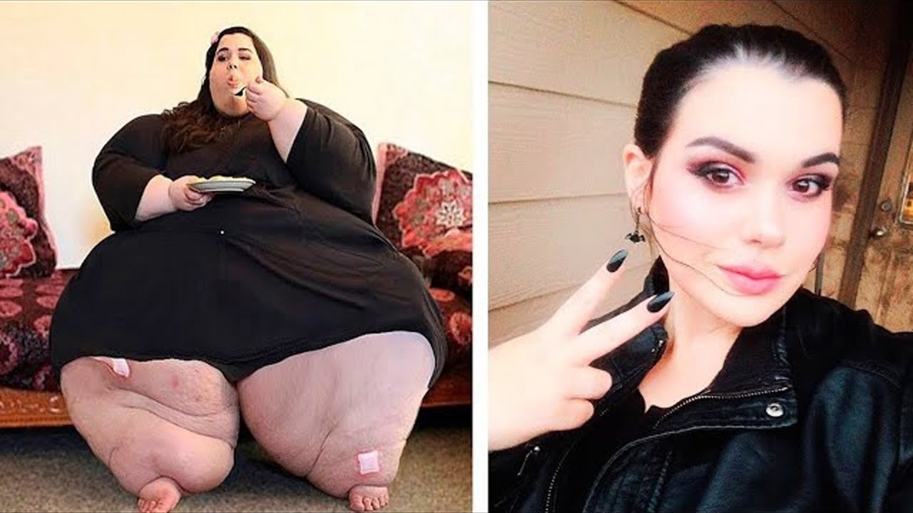 Çfarë ndodhi me gruan më të shëndoshë bë botë, këto pamje do tju lënë pafjal (VIDEO)