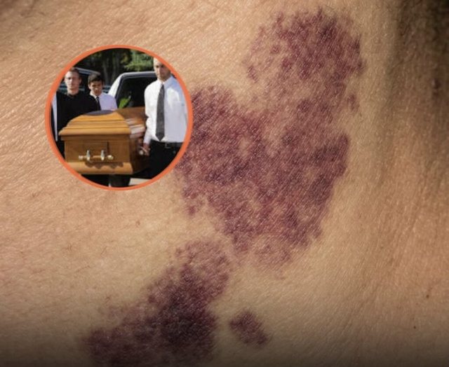 Detaje shokuese: Adoleshenti humbi jetën pasi u kafshua në qafë nga e dashura..!