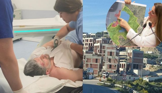 Çmenduri!“Fut e bjer” mes miliarderëve: Plas grushti mes pronarëve të “Manastiri Resort”